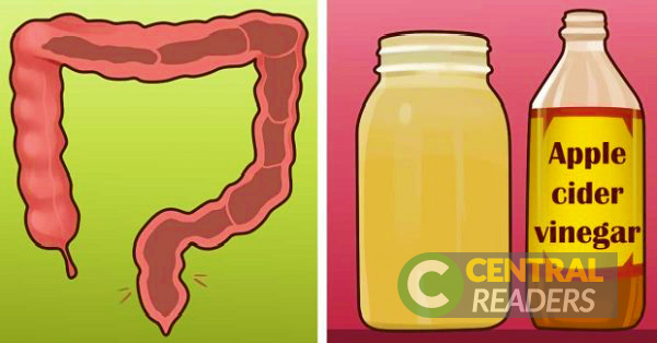 Eliminate Accumulated Toxins In The Colon Using Only These Two Ingredients. Here’s HOW